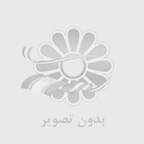 كاشت مو به روش micro fit در تهران